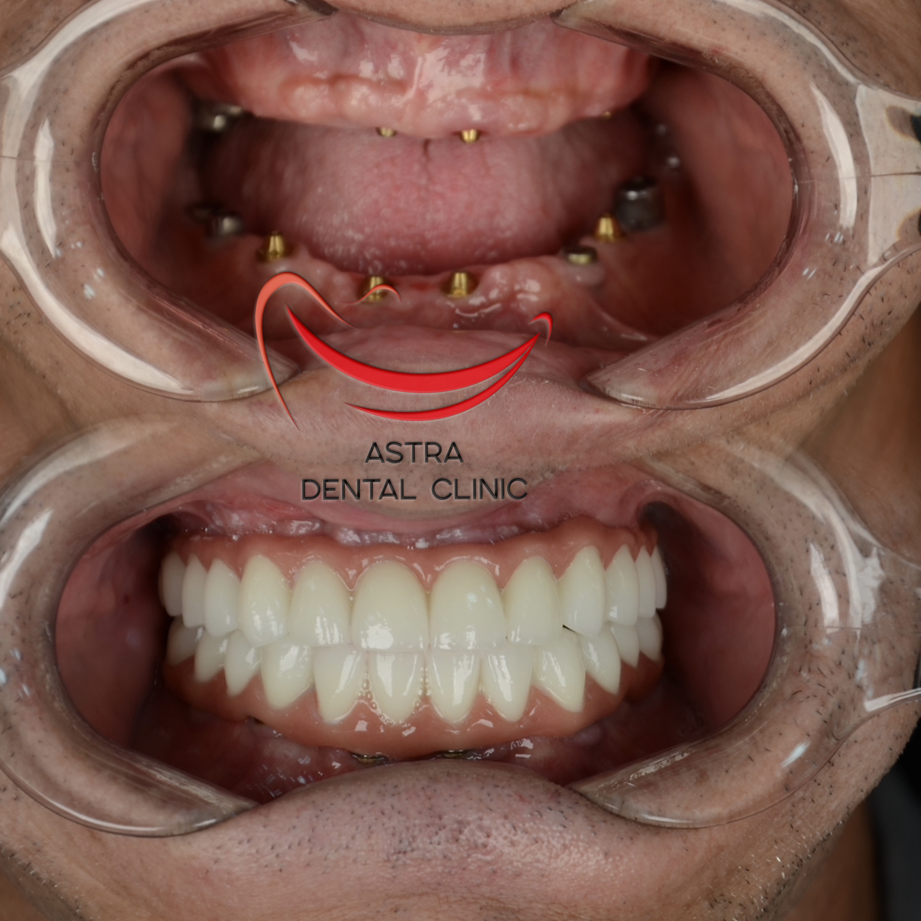 ����� �-Astra Dental Clinic